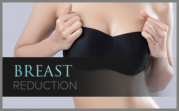 Breast Reduction – Female