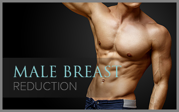 Breast Reduction – Male